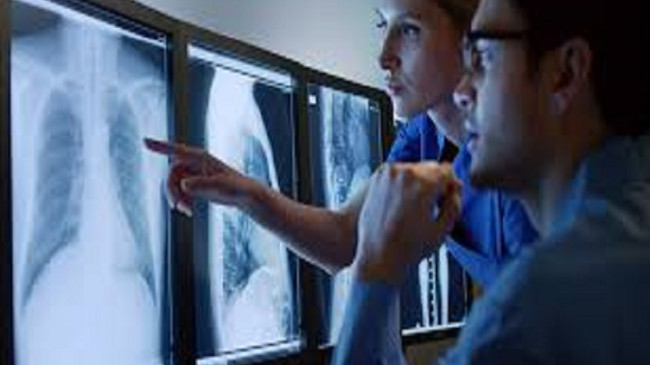 Radyoloji birimi çalışanlarına Önemli Riskli Birim Kararı